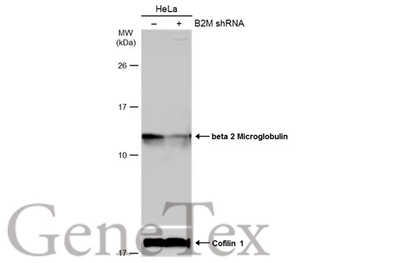 Mouse plasma (50 ug) was separated by 15% SDS-PAGE,and the membrane was blotted with beta 2 Microglobulin antibody (GTX112815) diluted at 1:1500. The HRP-conjugated anti-rabbit IgG antibody (GTX213110-01) was used to detect the primary antibody.