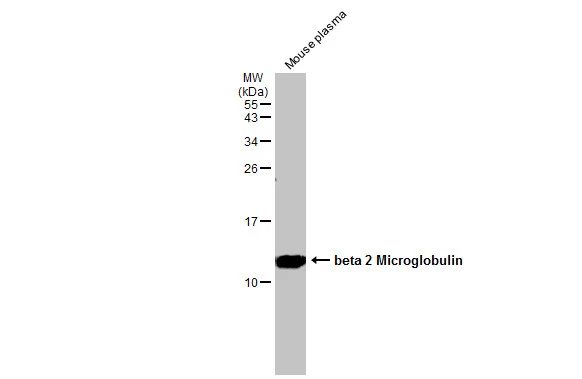 Anti-beta 2 Microglobulin antibody (GTX112815) | GeneTex