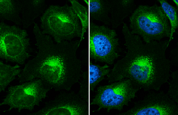 Anti-beta 2 Microglobulin antibody (GTX112815) | GeneTex