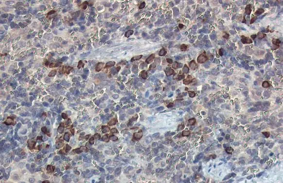 Anti-beta 2 Microglobulin antibody (GTX112815) | GeneTex