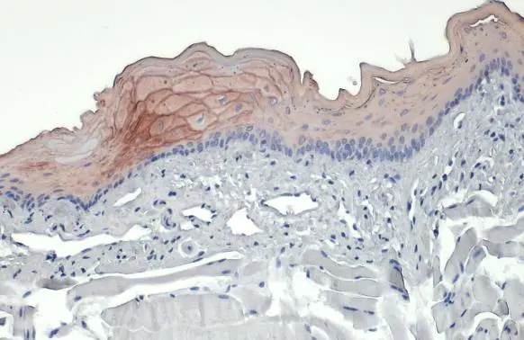 Cytokeratin 19 antibody [N1C1] detects Cytokeratin 19 protein at cell membrane by immunohistochemical analysis. Sample: Paraffin-embedded mouse tongue. Cytokeratin 19 stained by Cytokeratin 19 antibody [N1C1] (GTX112826) diluted at 1:500. Antigen Retrieval: Citrate buffer, pH 6.0, 15 min