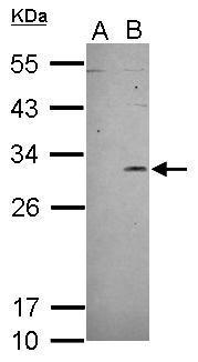 Sample (30 ug of whole cell lysate) A: HeLa (control) B: HeLa treated with tunicamycin (4ug/ml) 12% SDS PAGE GTX112827 diluted at 1:500 The HRP-conjugated anti-rabbit IgG antibody (GTX213110-01) was used to detect the primary antibody.