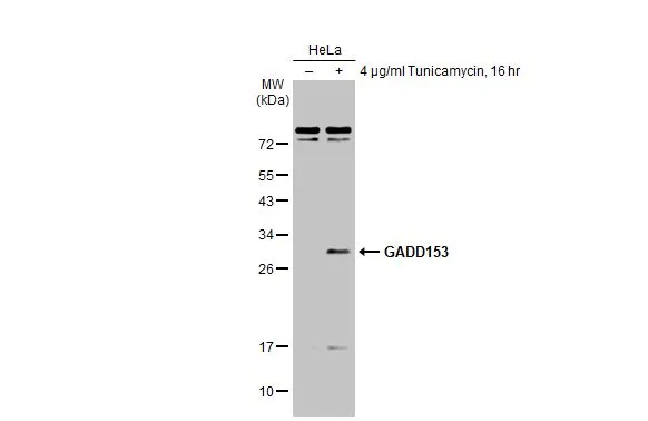 Untreated (–) and treated (+) HeLa whole cell extracts (30 μg) were separated by 12% SDS-PAGE, and the membrane was blotted with GADD153 antibody [N1C3] (GTX112827) diluted at 1:500. The HRP-conjugated anti-rabbit IgG antibody (GTX213110-01) was used to detect the primary antibody.