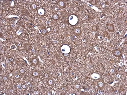 EPO antibody