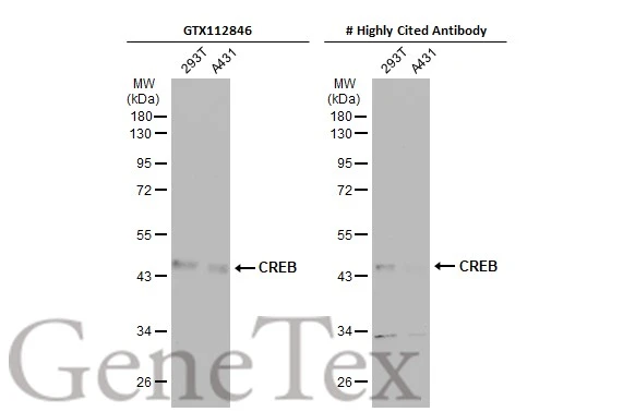 Various whole cell extracts (30 μg) were separated by 10% SDS-PAGE, and the membranes were blotted with CREB antibody (GTX112846) diluted at 1:500 and competitor's antibody diluted at 1:500. The HRP-conjugated anti-rabbit IgG antibody (GTX213110-01) was used to detect the primary antibody. *The competitor is not affiliated with GeneTex and does not endorse this product.