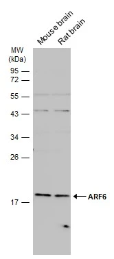 Various tissue extracts (50 μg) were separated by 12% SDS-PAGE, and the membrane was blotted with ARF6 antibody (GTX112872) diluted at 1:1000. The HRP-conjugated anti-rabbit IgG antibody (GTX213110-01) was used to detect the primary antibody.