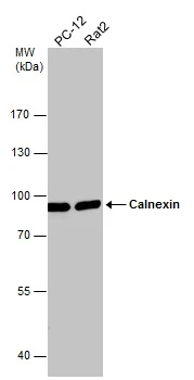 Various whole cell extracts (30 μg) were separated by 7.5% SDS-PAGE, and the membrane was blotted with Calnexin antibody (GTX112886) diluted at 1:1000. Various whole cell extracts (30 μg) were separated by 7.5% SDS-PAGE, and the membrane was blotted with Calnexin antibody (GTX112886) diluted at 1:1000.