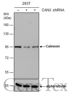 Non-transfected (–) and transfected (+) 293T whole cell extracts (15 μg) were separated by 7.5% SDS-PAGE, and the membrane was blotted with Calnexin antibody (GTX112886) diluted at 1:10000. Non-transfected (–) and transfected (+) 293T whole cell extracts (15 μg) were separated by 7.5% SDS-PAGE, and the membrane was blotted with Calnexin antibody (GTX112886) diluted at 1:10000.
