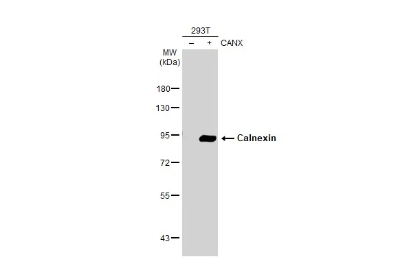 Non-transfected (–) and transfected (+) 293T whole cell extracts (30 μg) were separated by 7.5% SDS-PAGE, and the membrane was blotted with Calnexin antibody (GTX112886) diluted at 1:5000. The HRP-conjugated anti-rabbit IgG antibody (GTX213110-01) was used to detect the primary antibody. Non-transfected (–) and transfected (+) 293T whole cell extracts (30 μg) were separated by 7.5% SDS-PAGE, and the membrane was blotted with Calnexin antibody (GTX112886) diluted at 1:5000. The HRP-conjugated anti-rabbit IgG antibody (GTX213110-01) was used to detect the primary antibody.