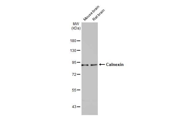 Various tissue extracts (50 μg) were separated by 7.5% SDS-PAGE, and the membrane was blotted with Calnexin antibody (GTX112886) diluted at 1:1000. The HRP-conjugated anti-rabbit IgG antibody (GTX213110-01) was used to detect the primary antibody.