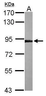 Sample (50 ug of whole cell lysate) A: mouse liver 7.5% SDS PAGE GTX112886 diluted at 1:1000 Sample (50 ug of whole cell lysate) A: mouse liver 7.5% SDS PAGE GTX112886 diluted at 1:1000