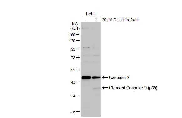 Untreated (–) and treated (+) HeLa whole cell extract (30 μg) were separated by 10% SDS-PAGE, and the membrane was blotted with Caspase 9 antibody [N2C3] (GTX112888) diluted at 1:500. The HRP-conjugated anti-rabbit IgG antibody (GTX213110-01) was used to detect the primary antibody, and the signal was developed with Trident ECL plus-Enhanced.