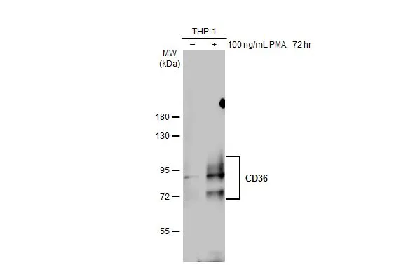 ぴぴ Anti-CD36 antibody (GTX112891) | GeneTex