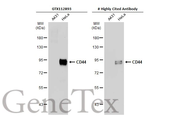 Various whole cell extracts (30 μg) were separated by 7.5% SDS-PAGE, and the membranes were blotted with CD44 antibody [N1N2], N-term (GTX112893) diluted at 1:500 and competitor's antibody diluted at 1:500. The HRP-conjugated anti-rabbit IgG antibody (GTX213110-01) was used to detect the primary antibody. *The competitor is not affiliated with GeneTex and does not endorse this product.