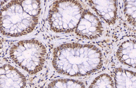 p21 Cip1 antibody detects p21 Cip1 protein at nucleus by immunohistochemical analysis (Autostainer Formulated). Sample: Paraffin-embedded human normal colon tissue. p21 Cip1 stained by p21 Cip1 antibody (GTX112898) diluted at 1:500. Antigen Retrieval: EDTA buffer, 20 min