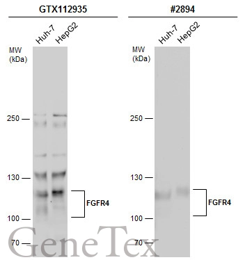Various whole cell extracts (30 μg) were separated by 5% SDS-PAGE, and the membranes were blotted with FGFR4 antibody [N3C2], Internal (GTX112935) diluted at 1:500 and competitor's antibody (CST#2894) diluted at 1:100. The HRP-conjugated anti-rabbit IgG antibody (GTX213110-01) was used to detect the primary antibody, and the signal was developed with Trident ECL plus-Enhanced.