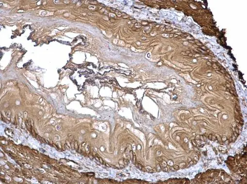 Filamin A antibody [C2], C-term detects Filamin A protein at cytosol on mouse esophagus by immunohistochemical analysis. Sample: Paraffin-embedded mouse esophagus. Filamin A antibody [C2], C-term (GTX112939) dilution: 1:500. 
 Antigen Retrieval: Trilogy? (EDTA based, pH 8.0) buffer, 15min