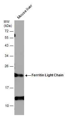 Mouse tissue extract (50 μg) was separated by 12% SDS-PAGE, and the membrane was blotted with Ferritin Light Chain antibody [N1C3-3] (GTX112943) diluted at 1:1000.