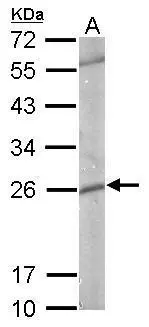 Sample (50 μg of whole cell lysate) A: mouse brain 12% SDS PAGE GTX112953 diluted at 1:1000 The HRP-conjugated anti-rabbit IgG antibody (GTX213110-01) was used to detect the primary antibody. Sample (50 μg of whole cell lysate) A: mouse brain 12% SDS PAGE GTX112953 diluted at 1:1000 The HRP-conjugated anti-rabbit IgG antibody (GTX213110-01) was used to detect the primary antibody.