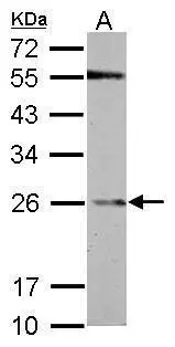 GSTP1 antibody detects GSTP1 protein by western blot analysis. A. 50 μg Rat brain lysate/extract 12% SDS-PAGE GSTP1 antibody (GTX112953) dilution: 1:1000 The HRP-conjugated anti-rabbit IgG antibody (GTX213110-01) was used to detect the primary antibody. GSTP1 antibody detects GSTP1 protein by western blot analysis. A. 50 μg Rat brain lysate/extract 12% SDS-PAGE GSTP1 antibody (GTX112953) dilution: 1:1000 The HRP-conjugated anti-rabbit IgG antibody (GTX213110-01) was used to detect the primary antibody.