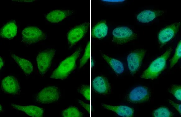 GSTP1 antibody detects GSTP1 protein at cytoplasm and nucleus by immunofluorescent analysis. Sample: HeLa cells were fixed in 4% paraformaldehyde at RT for 15 min. Green: GSTP1 stained by GSTP1 antibody (GTX112953) diluted at 1:500. Blue: Fluoroshield with DAPI (GTX30920).