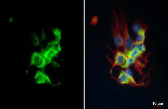 Hsp70 antibody detects Hsp70 protein at cytoplasm by immunofluorescent analysis. Sample: U87-MG cells were fixed in 4% paraformaldehyde at RT for 15 min. Green: Hsp70 stained by Hsp70 antibody (GTX112963) diluted at 1:500. Red: alpha Tubulin, a cytoskeleton marker, stained by alpha Tubulin antibody [GT114] (GTX628802) diluted at 1:1000. Blue: Fluoroshield with DAPI (GTX30920).