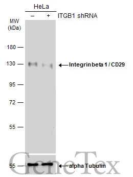 Non-transfected (–) and transfected (+) HeLa whole cell extracts (15 μg) were separated by 7.5% SDS-PAGE, and the membrane was blotted with Integrin beta 1 / CD29 antibody (GTX112971) diluted at 1:5000. The HRP-conjugated anti-rabbit IgG antibody (GTX213110-01) was used to detect the primary antibody.