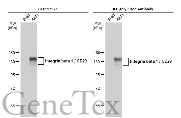 Various whole cell extracts (30 μg) were separated by 7.5% SDS-PAGE, and the membranes were blotted with Integrin beta 1 / CD29 antibody (GTX112971) diluted at 1:3000 and competitor's antibody diluted at 1:3000. The HRP-conjugated anti-rabbit IgG antibody (GTX213110-01) was used to detect the primary antibody. *The competitor is not affiliated with GeneTex and does not endorse this product.