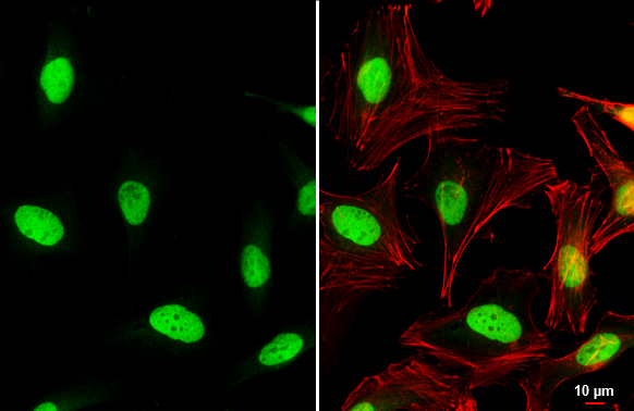 c-Jun antibody detects c-Jun protein at nucleus by immunofluorescent analysis. Sample: HeLa cells were fixed in 4% paraformaldehyde at RT for 15 min. Green: c-Jun stained by c-Jun antibody (GTX112974) diluted at 1:500. Red: phalloidin, a cytoskeleton marker, diluted at 1:100. Scale bar= 10 μm. c-Jun antibody detects c-Jun protein at nucleus by immunofluorescent analysis. Sample: HeLa cells were fixed in 4% paraformaldehyde at RT for 15 min. Green: c-Jun stained by c-Jun antibody (GTX112974) diluted at 1:500. Red: phalloidin, a cytoskeleton marker, diluted at 1:100. Scale bar= 10 μm.