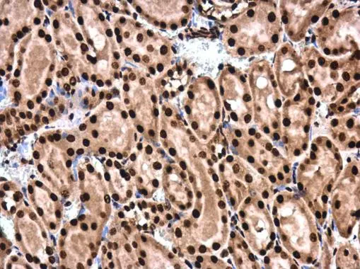 Anti-SMAD4 antibody (GTX112980) | GeneTex