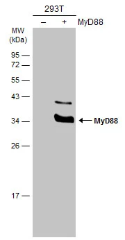 Non-transfected (–) and transfected (+) 293T whole cell extracts (30 μg) were separated by 12% SDS-PAGE, and the membrane was blotted with MyD88 antibody (GTX112986) diluted at 1:5000. The HRP-conjugated anti-rabbit IgG antibody (GTX213110-01) was used to detect the primary antibody.