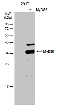 Non-transfected (–) and transfected (+) 293T whole cell extracts (30 μg) were separated by 12% SDS-PAGE, and the membrane was blotted with MyD88 antibody (GTX112987) diluted at 1:5000. The HRP-conjugated anti-rabbit IgG antibody (GTX213110-01) was used to detect the primary antibody.