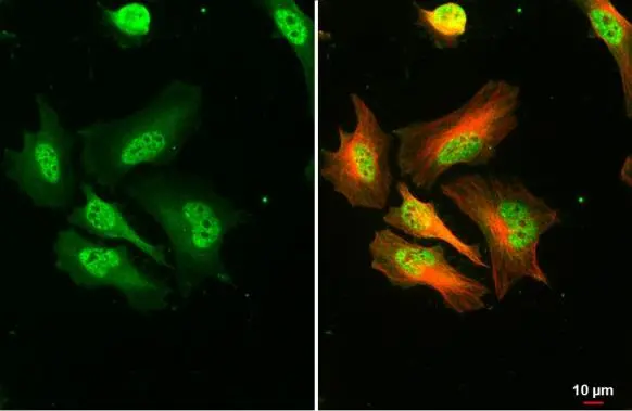 RPA32 antibody detects RPA32 protein at nucleus by immunofluorescent analysis. Sample: HeLa cells were fixed in 4% paraformaldehyde at RT for 15 min. Green: RPA32 stained by RPA32 antibody (GTX113004) diluted at 1:500. Red: alpha Tubulin, a cytoskeleton marker, stained by alpha Tubulin antibody [GT114] (GTX628802) diluted at 1:1000.