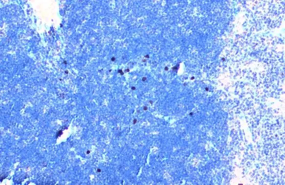 Anti-TLR3 antibody (GTX113022) | GeneTex
