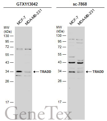 Various whole cell extracts (30 μg) were separated by 12% SDS-PAGE, and the membranes were blotted with TRADD antibody [N2C3] (GTX113042) diluted at 1:500 and competitor's antibody (sc-7868) diluted at 1:100. The HRP-conjugated anti-rabbit IgG antibody (GTX213110-01) was used to detect the primary antibody.
