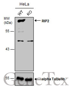 Wild-type (WT) and RIP2 knockout (KO) HeLa cell extracts (30 μg) were separated by 7.5% SDS-PAGE, and the membrane was blotted with RIP2 antibody [C1C3] (GTX113045) diluted at 1:500. The HRP-conjugated anti-rabbit IgG antibody (GTX213110-01) was used to detect the primary antibody.