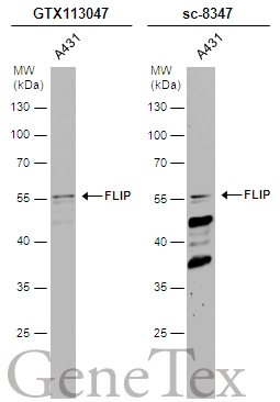 Whole cell extract (30 μg) was separated by 10% SDS-PAGE, and the membranes were blotted with FLIP antibody [N1C1] (GTX113047) diluted at 1:500 and competitor's antibody (sc-8347) diluted at 1:200. The HRP-conjugated anti-rabbit IgG antibody (GTX213110-01) was used to detect the primary antibody.
