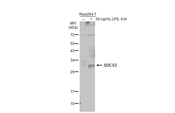Untreated (–) and treated (+) Raw264.7 whole cell extracts (50 μg) were separated by 12% SDS-PAGE, and the membrane was blotted with SOCS3 antibody [N1C3] (GTX113049) diluted at 1:500. The HRP-conjugated anti-rabbit IgG antibody (GTX213110-01) was used to detect the primary antibody, and the signal was developed with Trident ECL plus-Enhanced.