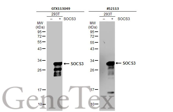 Non-transfected (–) and transfected (+) 293T whole cell extracts (30 μg) were separated by 12% SDS-PAGE, and the membranes were blotted with SOCS3 antibody [N1C3] (GTX113049) diluted at 1:10000 and competitor's antibody (#52113) diluted at 1:5000. The HRP-conjugated anti-rabbit IgG antibody (GTX213110-01) was used to detect the primary antibody. *The competitor is not affiliated with GeneTex and does not endorse this product.