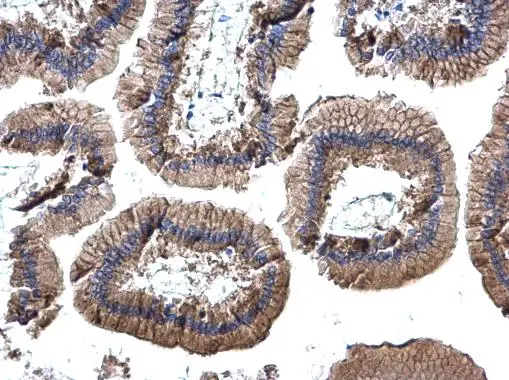 EpCAM antibody [N3C3] detects EpCAM protein at cell membrane by immunohistochemical analysis. Sample: Paraffin-embedded mouse duodenum. EpCAM stained by EpCAM antibody [N3C3] (GTX113091) diluted at 1:500.
 Antigen Retrieval: Trilogy? (EDTA based, pH 8.0) buffer, 15min