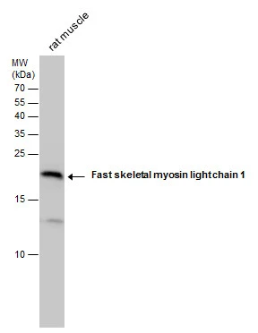 Fast skeletal myosin light chain 1 antibody detects Fast skeletal myosin light chain 1 protein by Western blot analysis. Rat tissue extracts (1 μg) was separated by 15 % SDS-PAGE, and the membrane was blotted with Fast skeletal myosin light chain 1 antibody (GTX113092) at a dilution of 1:20000.
