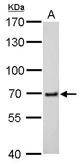 cIAP2 antibody detects cIAP2 protein by western blot analysis. A. 50 μg rat spleen lysate/extract 7.5% SDS-PAGE cIAP2 antibody (GTX113128) dilution: 1:500 The HRP-conjugated anti-rabbit IgG antibody (GTX213110-01) was used to detect the primary antibody.