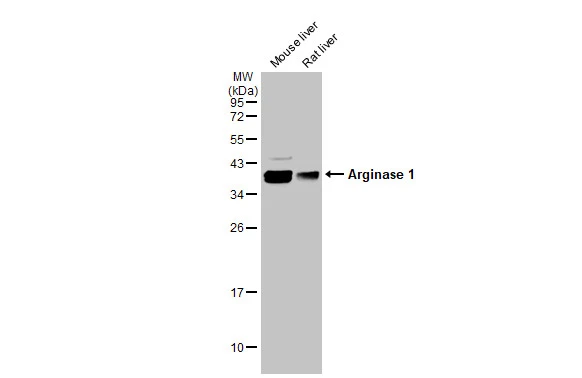 Various tissue extracts (50 μg) were separated by 12% SDS-PAGE, and the membrane was blotted with Arginase 1 antibody (GTX113131) diluted at 1:30000. The HRP-conjugated anti-rabbit IgG antibody (GTX213110-01) was used to detect the primary antibody.