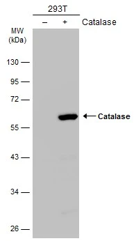 Catalase antibody [N2C1], Internal