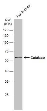 Catalase antibody [N2C1], Internal