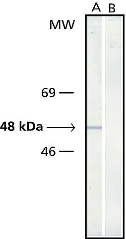 WB analysis of chicken fibroblasts using GTX11316 gamma Tubulin antibody [GTU-88]. Lane A : Antibody dilution 1:20,000 Lane B : Negative control (secondary antibody only)