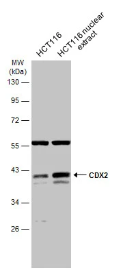 HCT116 whole cell and nuclear extracts (30 μg) were separated by 10% SDS-PAGE, and the membrane was blotted with CDX2 antibody (GTX113160) diluted at 1:1000. The HRP-conjugated anti-rabbit IgG antibody (GTX213110-01) was used to detect the primary antibody. HCT116 whole cell and nuclear extracts (30 μg) were separated by 10% SDS-PAGE, and the membrane was blotted with CDX2 antibody (GTX113160) diluted at 1:1000. The HRP-conjugated anti-rabbit IgG antibody (GTX213110-01) was used to detect the primary antibody.