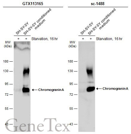 SH-SY-5Y whole cell extract and conditioned medium (30 μg) were separated by 7.5% SDS-PAGE, and the membranes were blotted with Chromogranin A antibody (GTX113165) diluted at 1:500 and competitor's antibody (sc-1488) diluted at 1:100. The HRP-conjugated anti-rabbit IgG antibody (GTX213110-01) was used to detect the primary antibody.