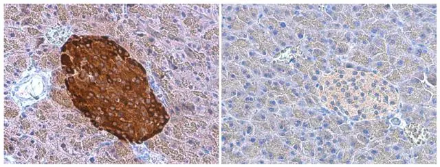 Chromogranin A antibody detects Chromogranin A protein at cytoplasm by immunohistochemical analysis. Sample: Paraffin-embedded mouse pancreas. Chromogranin A stained by Chromogranin A antibody (GTX113165) diluted at 1:2000 and competitor's antibody (sc-1488) diluted at 1:20. *Competitor's antibody is not affiliated with GeneTex and does not endorse this product.
Antigen Retrieval: Citrate buffer, pH 6.0, 15 min Chromogranin A antibody detects Chromogranin A protein at cytoplasm by immunohistochemical analysis. Sample: Paraffin-embedded mouse pancreas. Chromogranin A stained by Chromogranin A antibody (GTX113165) diluted at 1:2000 and competitor's antibody (sc-1488) diluted at 1:20. *Competitor's antibody is not affiliated with GeneTex and does not endorse this product.
Antigen Retrieval: Citrate buffer, pH 6.0, 15 min