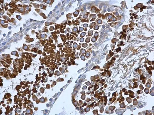 COPB antibody [N1N2], N-term detects COPB protein at cytoplasm in rat testis by immunohistochemical analysis. Sample: Paraffin-embedded rat testis. COPB antibody [N1N2], N-term (GTX113167) diluted at 1:500. 
 Antigen Retrieval: Citrate buffer, pH 6.0, 15 min
